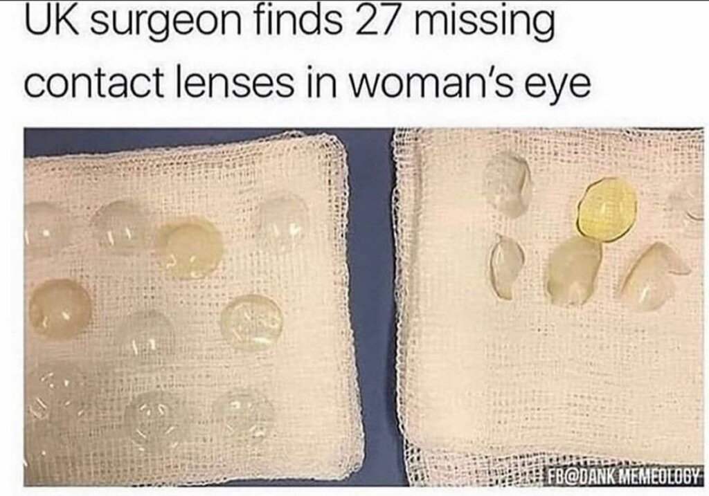 수술중 눈에서 27개의 렌즈가 나온 여자
